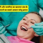 Dant Ka Kida Kaise Marein